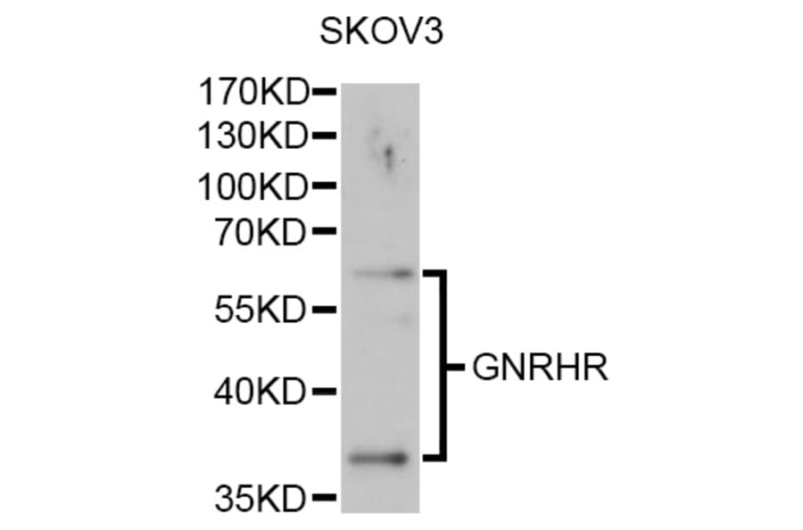 Western Blot - Anti-GNRHR Antibody (A1696) - Antibodies.com
