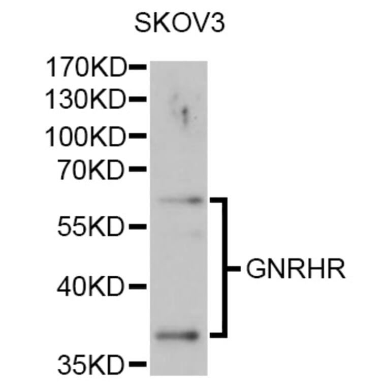 Western Blot - Anti-GNRHR Antibody (A1696) - Antibodies.com