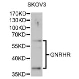 Western Blot - Anti-GNRHR Antibody (A1696) - Antibodies.com