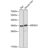 Western Blot - Anti-KIR2DL1 Antibody (A1697) - Antibodies.com