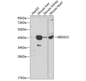 Western Blot - Anti-KIR2DL3 Antibody (A8958) - Antibodies.com