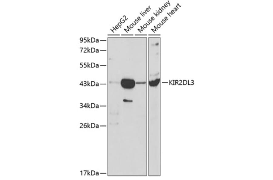 Western Blot - Anti-KIR2DL3 Antibody (A8958) - Antibodies.com