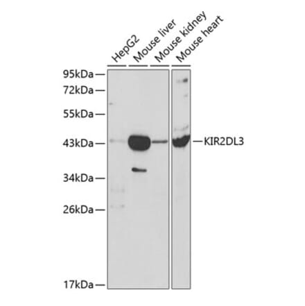 Western Blot - Anti-KIR2DL3 Antibody (A8958) - Antibodies.com