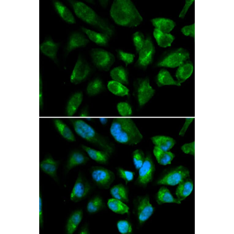 Immunofluorescence - Anti-KIR2DL3 Antibody (A8958) - Antibodies.com