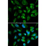 Immunofluorescence - Anti-KIR2DL3 Antibody (A8958) - Antibodies.com