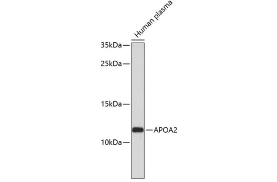 Western Blot - Anti-APOA2 Antibody (A1711) - Antibodies.com