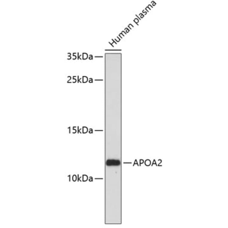Western Blot - Anti-APOA2 Antibody (A1711) - Antibodies.com