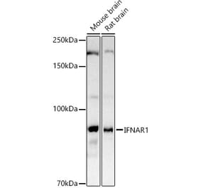 Western Blot - Anti-Interferon alpha/beta receptor 1 Antibody (A8960) - Antibodies.com