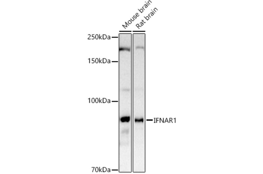 Western Blot - Anti-Interferon alpha/beta receptor 1 Antibody (A8960) - Antibodies.com