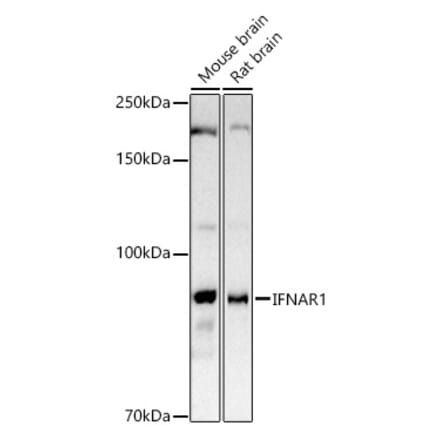 Western Blot - Anti-Interferon alpha/beta receptor 1 Antibody (A8960) - Antibodies.com