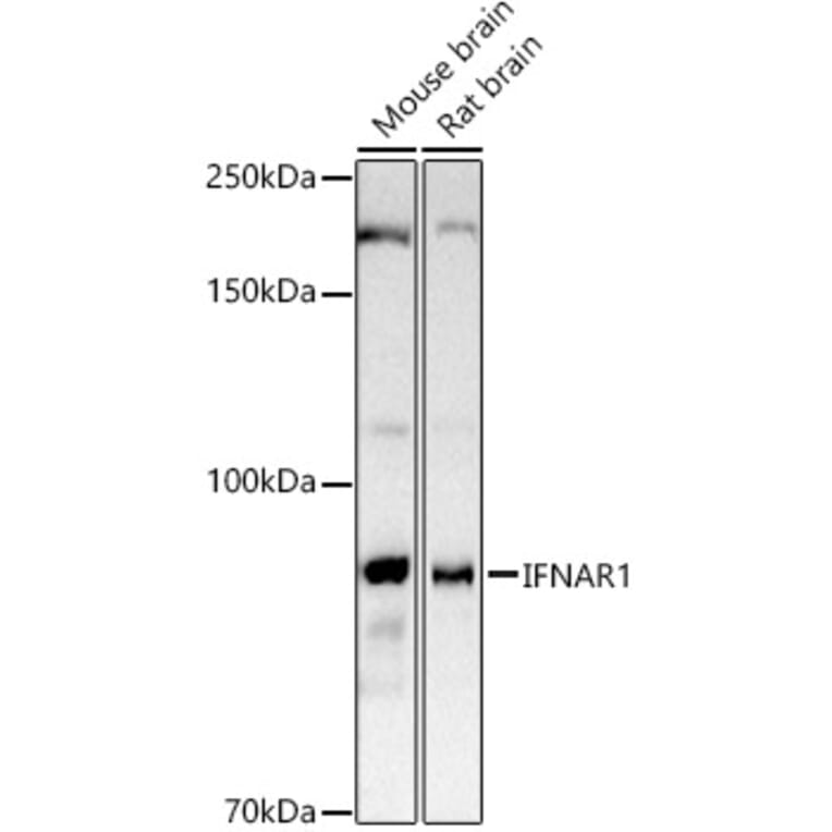 Western Blot - Anti-Interferon alpha/beta receptor 1 Antibody (A8960) - Antibodies.com
