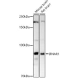 Western Blot - Anti-Interferon alpha/beta receptor 1 Antibody (A8960) - Antibodies.com