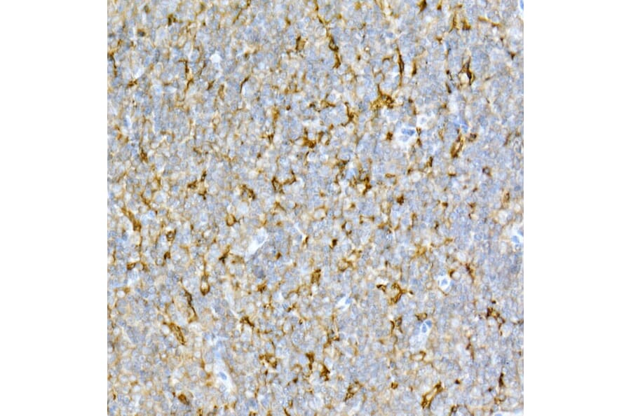 Immunohistochemistry - Anti-Interferon alpha/beta receptor 1 Antibody (A8960) - Antibodies.com