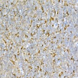 Immunohistochemistry - Anti-Interferon alpha/beta receptor 1 Antibody (A8960) - Antibodies.com