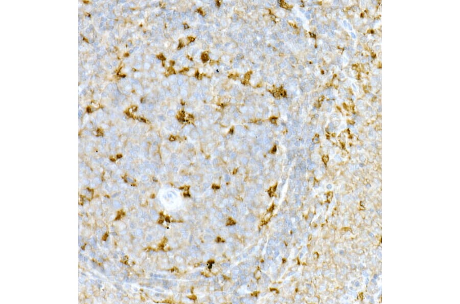 Immunohistochemistry - Anti-Interferon alpha/beta receptor 1 Antibody (A8960) - Antibodies.com