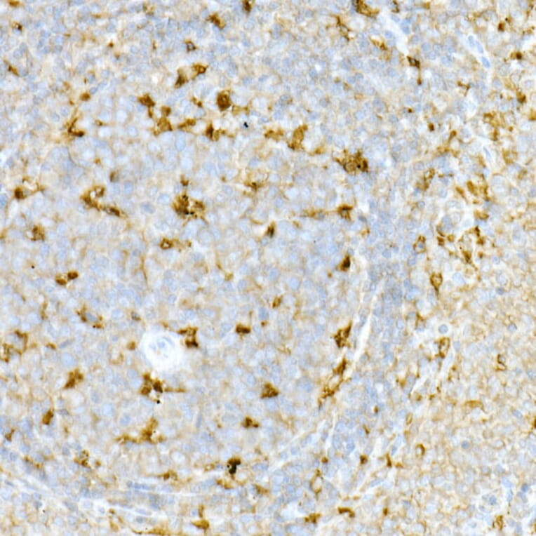Immunohistochemistry - Anti-Interferon alpha/beta receptor 1 Antibody (A8960) - Antibodies.com