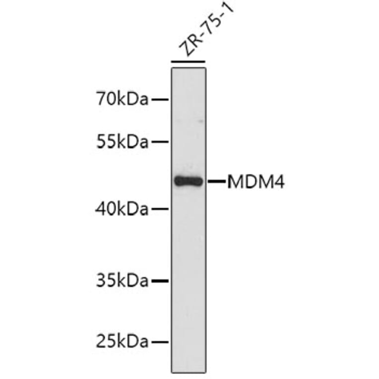 Western Blot - Anti-MDM4 Antibody (A1747) - Antibodies.com