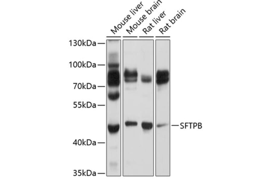 Western Blot - Anti-Surfactant Antibody (A8962) - Antibodies.com