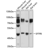 Western Blot - Anti-Surfactant Antibody (A8962) - Antibodies.com