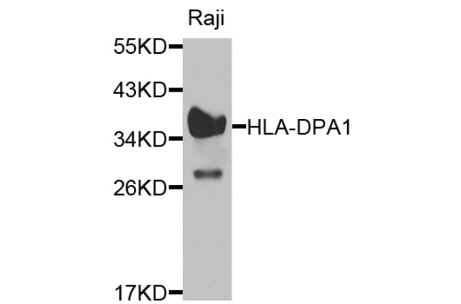Western Blot - Anti-HLA-DPA1 Antibody (A1754) - Antibodies.com