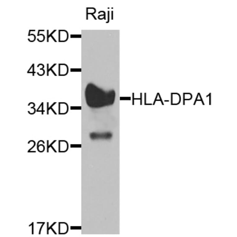 Western Blot - Anti-HLA-DPA1 Antibody (A1754) - Antibodies.com