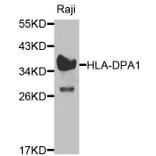 Western Blot - Anti-HLA-DPA1 Antibody (A1754) - Antibodies.com