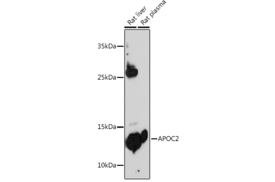 Western Blot - Anti-Apolipoprotein CII/ApoC-II Antibody (A8964) - Antibodies.com