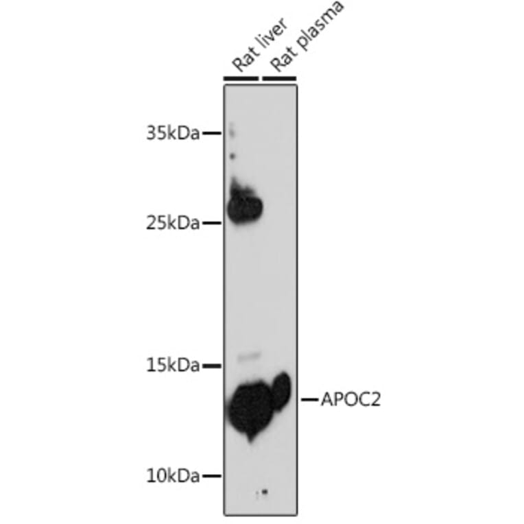 Western Blot - Anti-Apolipoprotein CII/ApoC-II Antibody (A8964) - Antibodies.com