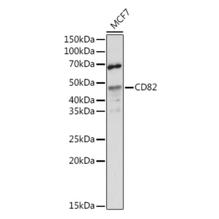Western Blot - Anti-CD82 Antibody (A8965) - Antibodies.com