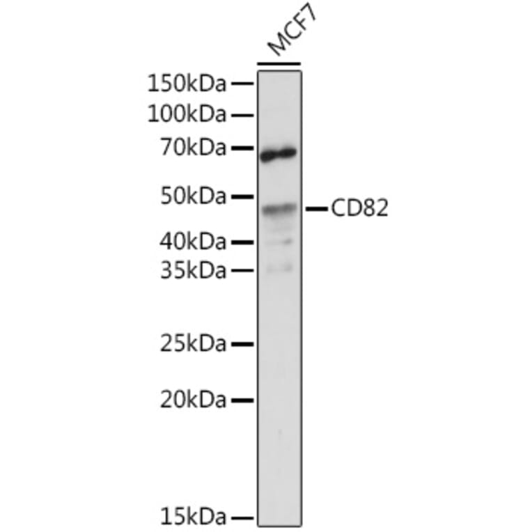 Western Blot - Anti-CD82 Antibody (A8965) - Antibodies.com