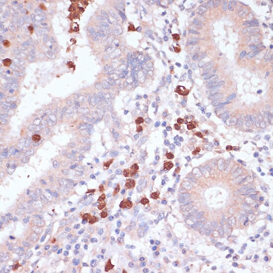 Anti-CD82 Antibody (A8965) | Antibodies.com
