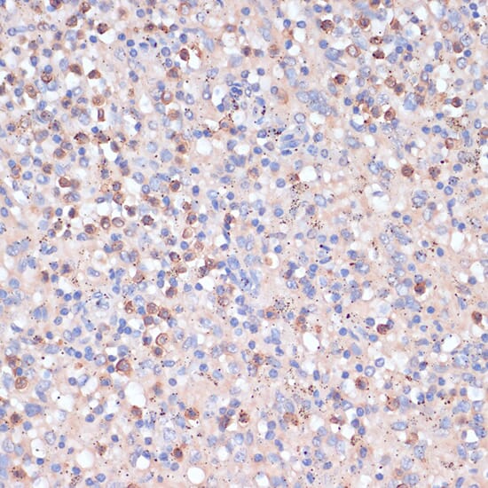 Anti-CD82 Antibody (A8965) | Antibodies.com Anti-CD82 Antibody (A8965) | Antibodies.com