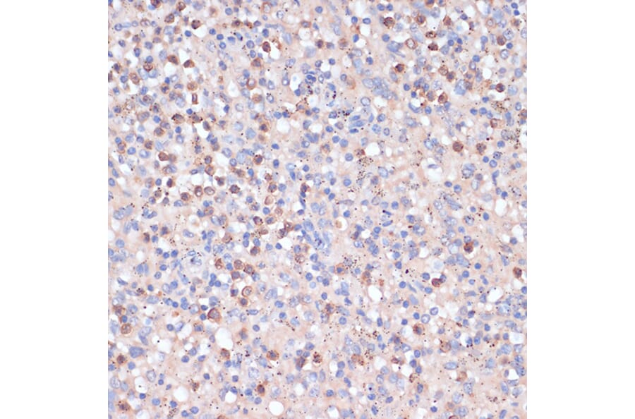 Immunohistochemistry - Anti-CD82 Antibody (A8965) - Antibodies.com