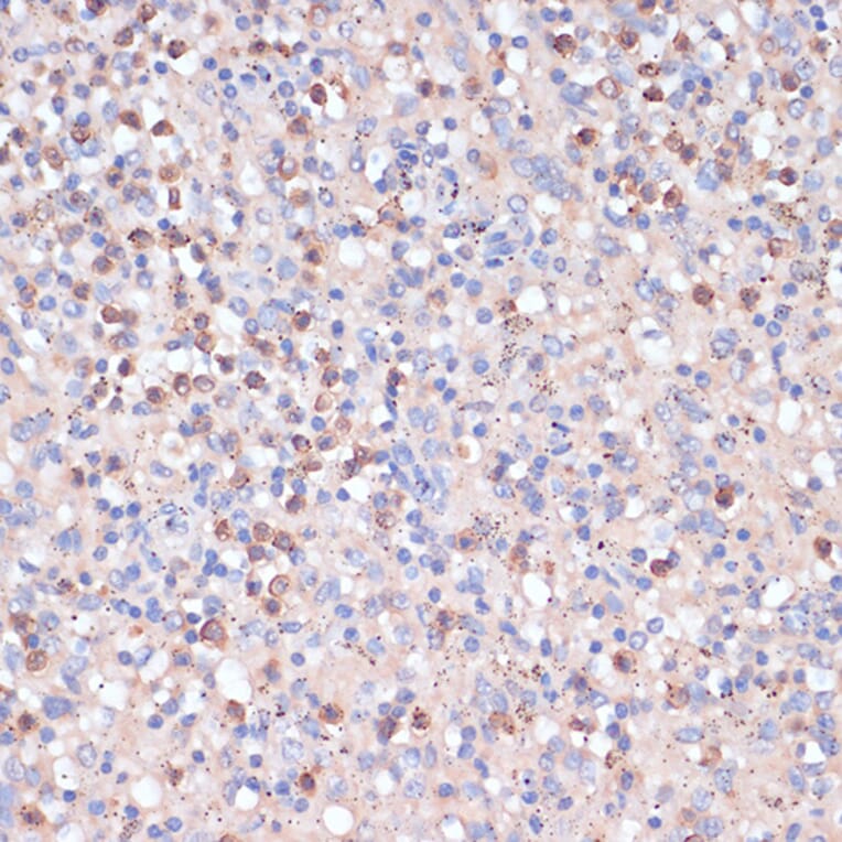 Immunohistochemistry - Anti-CD82 Antibody (A8965) - Antibodies.com