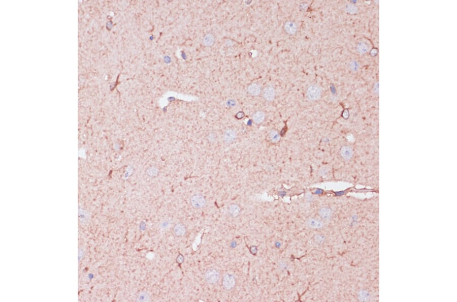 Immunohistochemistry - Anti-CD82 Antibody (A8965) - Antibodies.com