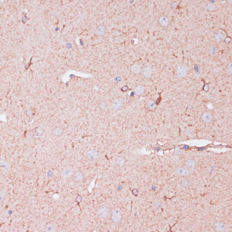 Immunohistochemistry - Anti-CD82 Antibody (A8965) - Antibodies.com