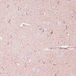 Immunohistochemistry - Anti-CD82 Antibody (A8965) - Antibodies.com