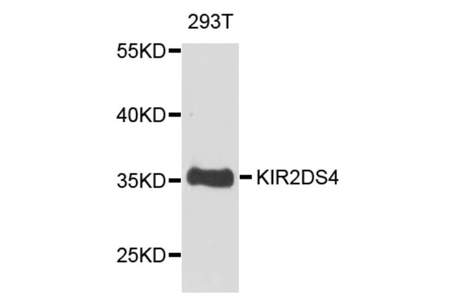 Western Blot - Anti-KIR2DS4 Antibody (A1779) - Antibodies.com
