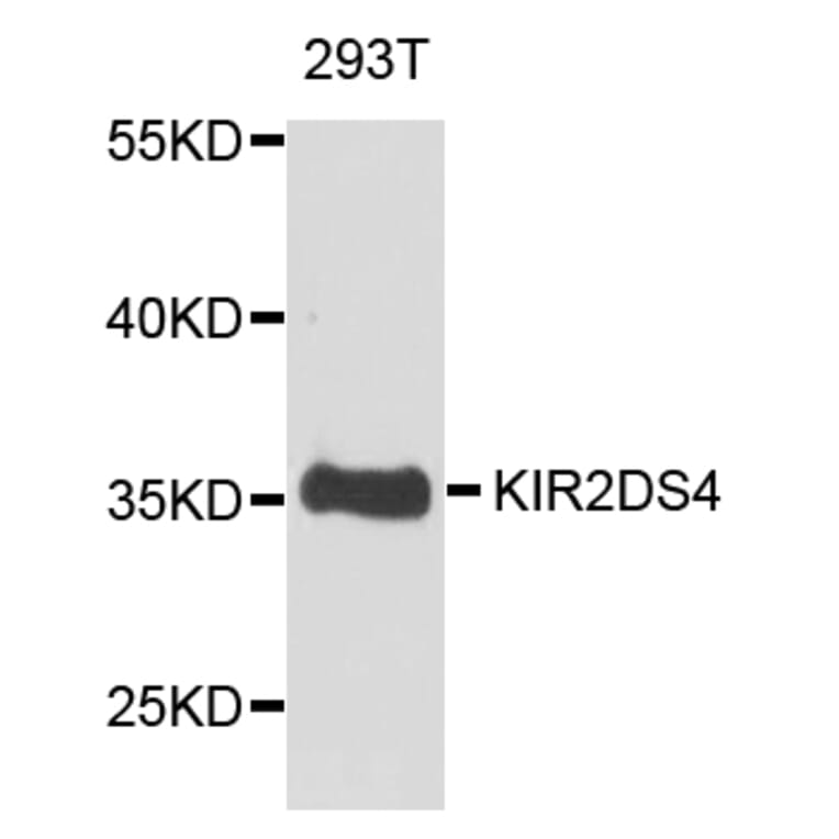 Western Blot - Anti-KIR2DS4 Antibody (A1779) - Antibodies.com