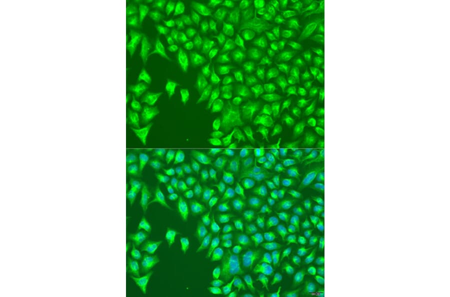 Immunofluorescence - Anti-KIR2DS4 Antibody (A1779) - Antibodies.com