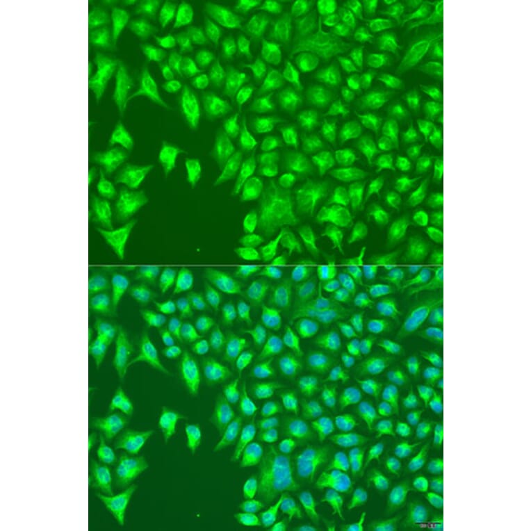 Immunofluorescence - Anti-KIR2DS4 Antibody (A1779) - Antibodies.com