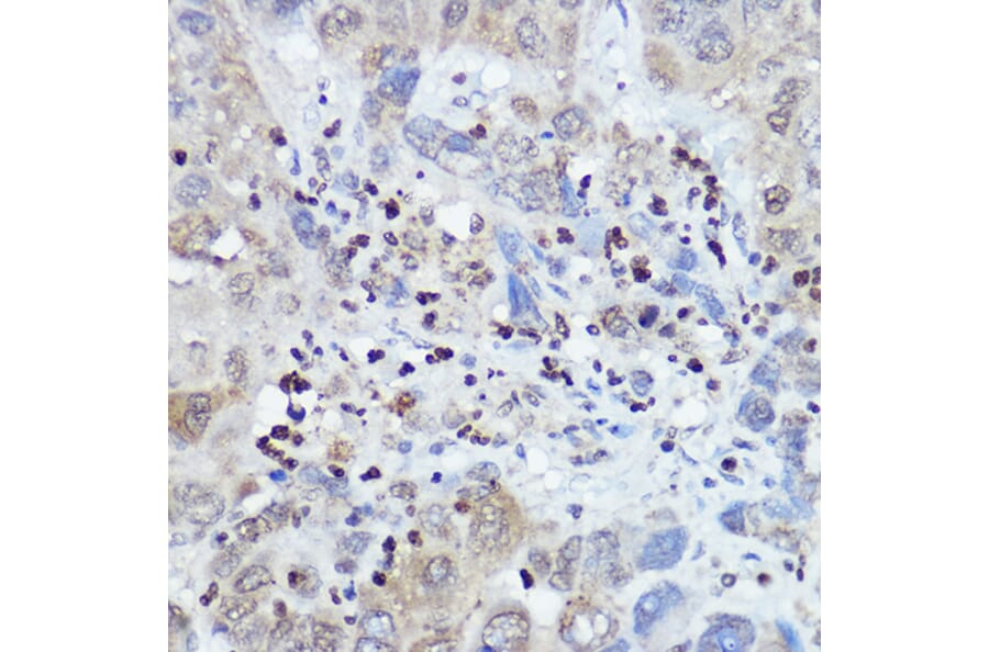 Immunohistochemistry - Anti-FANCC Antibody (A8967) - Antibodies.com