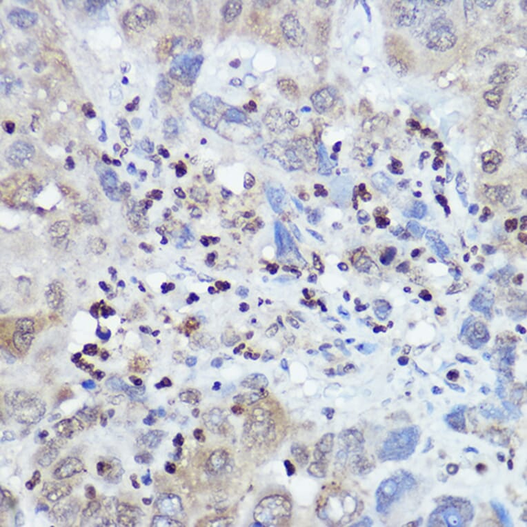 Immunohistochemistry - Anti-FANCC Antibody (A8967) - Antibodies.com