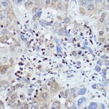 Immunohistochemistry - Anti-FANCC Antibody (A8967) - Antibodies.com