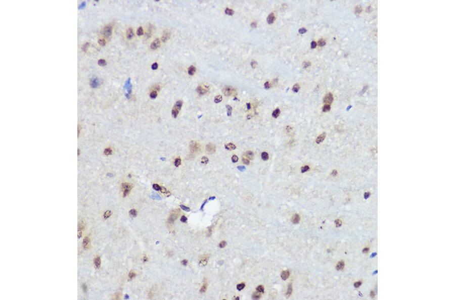 Immunohistochemistry - Anti-FANCC Antibody (A8967) - Antibodies.com
