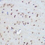 Immunohistochemistry - Anti-FANCC Antibody (A8967) - Antibodies.com