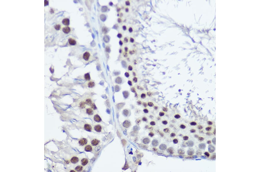 Immunohistochemistry - Anti-FANCC Antibody (A8967) - Antibodies.com