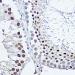 Immunohistochemistry - Anti-FANCC Antibody (A8967) - Antibodies.com