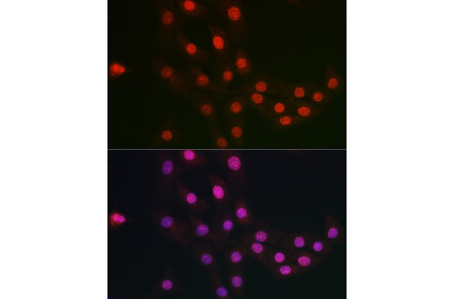 Immunofluorescence - Anti-FANCC Antibody (A8967) - Antibodies.com