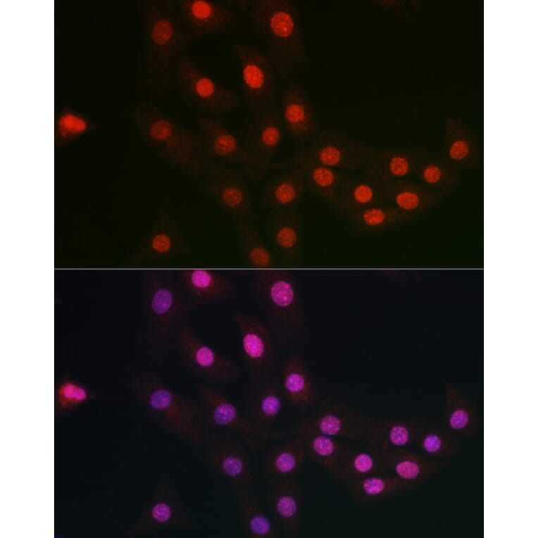Immunofluorescence - Anti-FANCC Antibody (A8967) - Antibodies.com